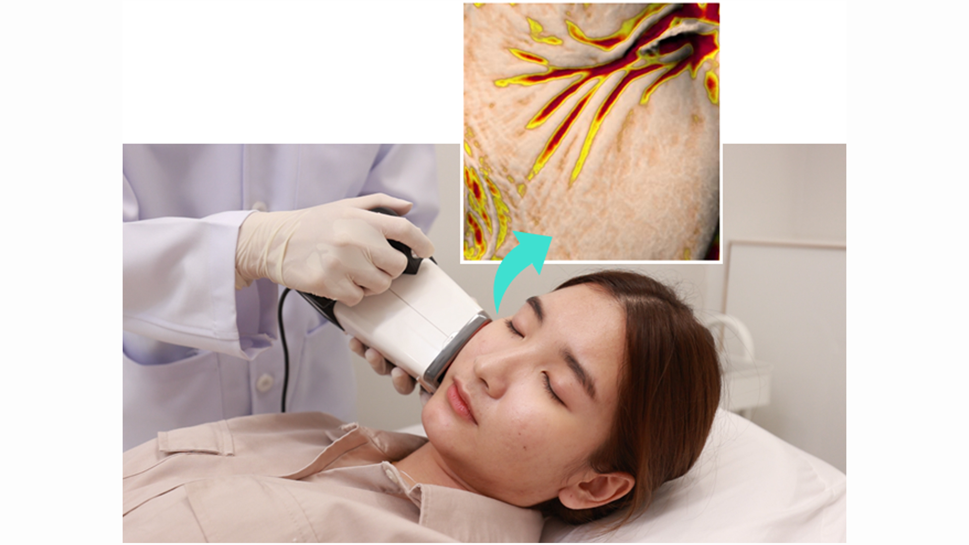 SKIN ANTI-AGING (IMPROVED SKIN FOLDS/CROW’S FEET TEST)