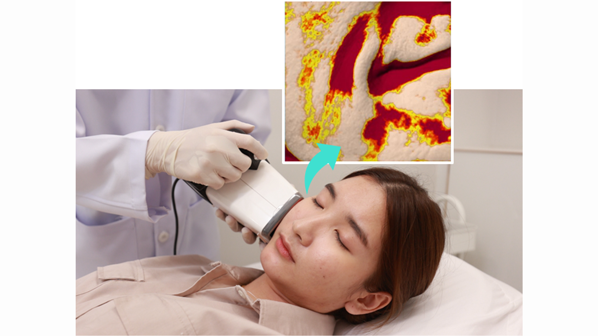 SKIN ANTI-AGING (IMPROVED SKIN VOLUMES/SCARS TEST)