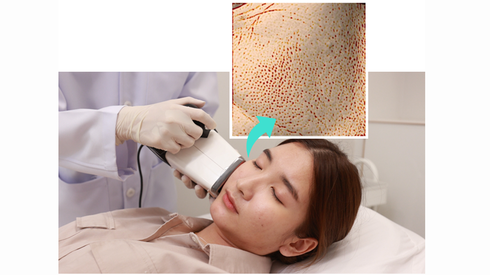 SKIN PORE TIGHTENING AND SMOOTHNESS TEST